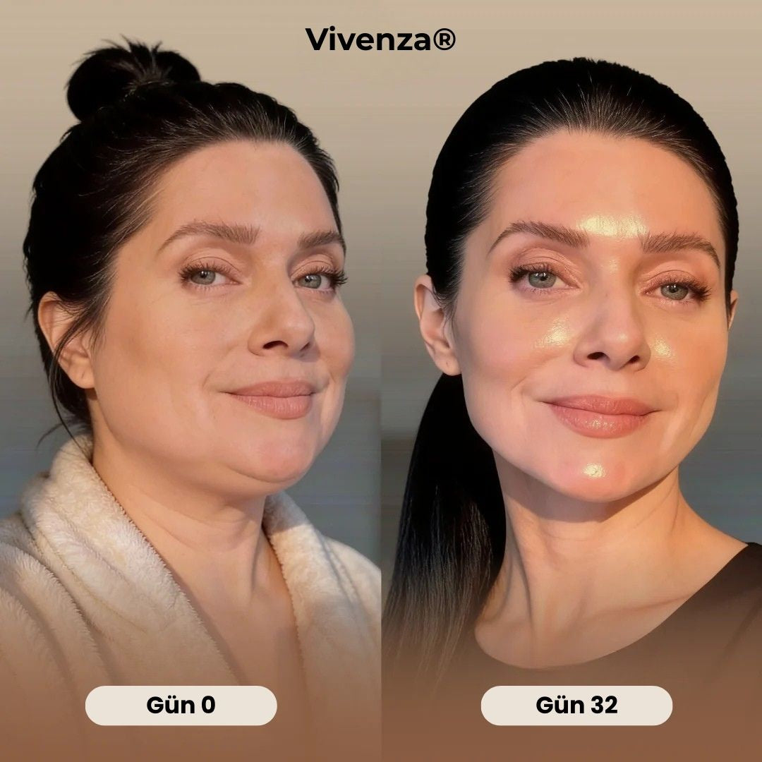 Vivenza® ContourMask: Profesyonel Çene Hattı Maskesi